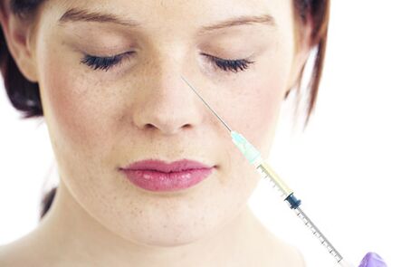 Rinoplastica non chirurgica con filler